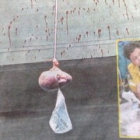An Italian Dead Head In Thailand: Close-Up Photos Of Severed Head Found Hanging From Rama VIII Bridge