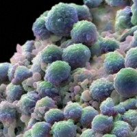 Intelligent Design Award: Biologist Says Cancer Is New Parasite-Species That Preys On Human Hosts