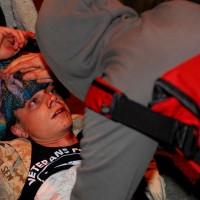 Photos Of Oakland #OWS Activist Shot In The Head With Rubber Bullets